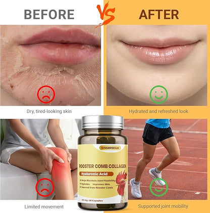 Rooster Comb Collagen, Natural Hyaluronic Acid Supplement for Joint Support, Mobility & Skin Hydration – 120mg 60 Capsule