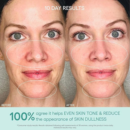 Algenist GENIUS Liquid Collagen Essence - Liquid Collagen Serum with Patented Alguronic Acid to Help Improve Skin Bounce, Elasticity & Radiance (100ml)