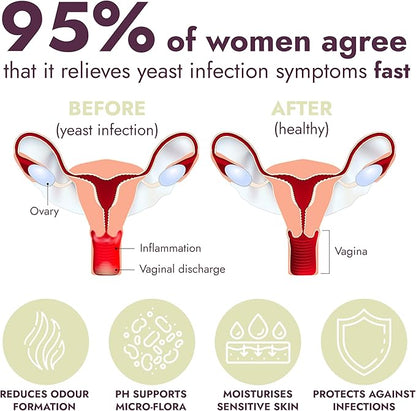 Terramed Just Think Comfort Yeast Infection Treatment for Women | Ph Balance for Women | Helps Relieve Itching & Irritation | Vaginal Aid for Inflammation, Dryness & Watery Discharge | 7 Count
