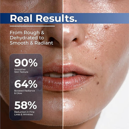 TURMSKIN® Hyaluronic Acid Serum Ampoules [ULTRA HYDRATING VIALS] - 3% Hyaluron Booster for Glass Skin & Anti Aging - 24 Hours Hydration - Soft PE Triple Hyaluronic Complex for Faceskin Repair & Renew