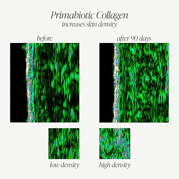 PRIMABIOTIC Liquid Collagen - High Collagen Content [10,000 Mg] Per Serving - Hydrolyzed Collagen and 12 Vitamins - Gluten Free- 450 Ml - Pack of 15 Bottles x 30 Ml