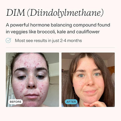 MDacne DIM Skin Clearing Supplements (30 Vegan Capsules) - for Acne Treatment, Estrogen Balance, Hormone Menopause Relief & Bodybuilding, Cruciferous Extract & Bioperine (30 Count (Pack of 1))
