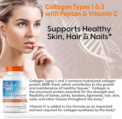 Doctors Best Collagen Types 1 and 3 & Vitamin C, Supports Hair, Skin, Nails, Bones, & Joints, Non-GMO, Gluten Free, Soy Free 540 Tablets