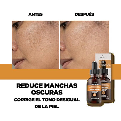 Purifect Vitamin C Brightening Facial Serum with Niacinamide & Vitamin E - Hydrating Serum for Face, Supports Even Skin Tone, Lightweight Daily Skincare, Made in USA - 1 fl oz